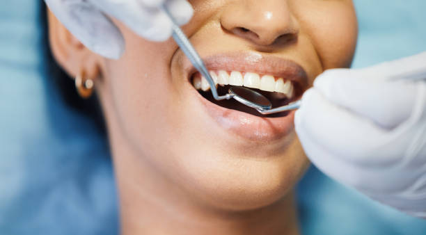 Best Emergency Care for Gum Disease in North Wildwood, NJ